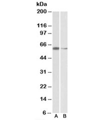 Western blot testing of HeLa [A] and K562 [B] nuclear lysates with ARIH2 antibody at 2ug/ml. Predicted molecular weight: ~58kDa.