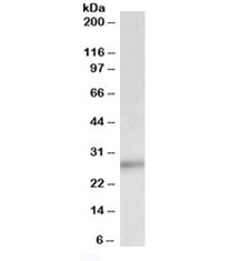 Western blot testing of human breast lysate with p27 antibody at 0.5ug/ml. Predicted molecular weight ~27kDa.