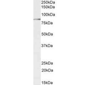 Western blot testing of human placental tissue lysate with TGM2 antibody at 0.03ug/ml. Predicted molecular weight: ~78 kDa.