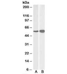 Western blot testing of human [A] and mouse [B] brain lysate with GDH antibody at 0.03ug/ml. Predicted molecular weight ~61kDa.