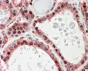 IHC staining of FFPE human thyroid gland with KCNN2 antibody at 4ug/ml. HIER: steamed with pH6 citrate buffer, AP-staining.