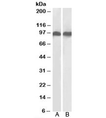 Western blot testing of human A) K562 and B) U937 cell lysates with LFA-1 antibody at 0.3ug/ml.  Predicted/observed molecular weight: 85~95 kDa depending on glycosylation level.