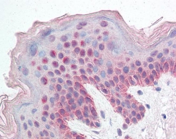 IHC testing of FFPE human skin tissue with KDM2B antibody at 5ug/ml. HIER: steamed antigen retrieval with pH6 citrate buffer; AP-staining.