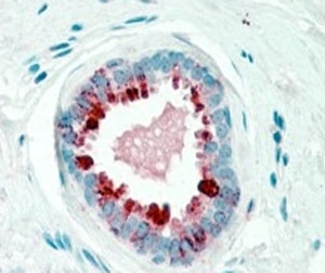 IHC staining of FFPE human breast with GCDFP-15 antibody at 2.5ug/ml. HIER: steamed with pH6 citrate buffer, AP-staining.