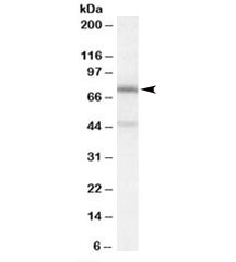 Western blot testing of A431 cell lysate with NO66 antibody at 0.3ug/ml. Predicted molecular weight: ~71 kDa. Both observed bands are blocked by addition of the immunizing peptide.