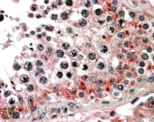 IHC testing of FFPE human testis with ABCB9 antibody at 4ug/ml. HIER: steamed with pH6 citrate buffer, AP-staining.