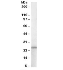 Western blot testing of human hippocampus lysate with PACAP antibody at 1ug/ml. Predicted molecular weight: ~19kDa, but can be observed at ~25kDa.