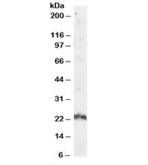 Western blot testing of human testis lysate with ARL4A antibody at 2ug/ml. Predicted/observed molecular weight: ~23kDa.
