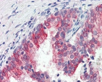 IHC testing of FFPE human prostate tissue with ROR1 antibody at 3ug/ml. Required HIER: steamed antigen retrieval with pH6 citrate buffer.