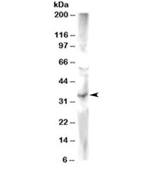 Western blot testing of human heart lysate with FRAT2 antibody at 2ug/ml. Predicted molecular weight ~25kDa.