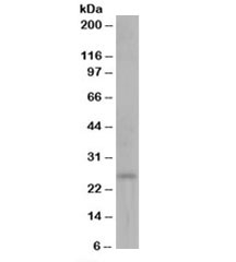 Western blot testing of human kidney lysate with DCXR antibody at 0.1ug/ml. Predicted molecular weight: ~26kDa.