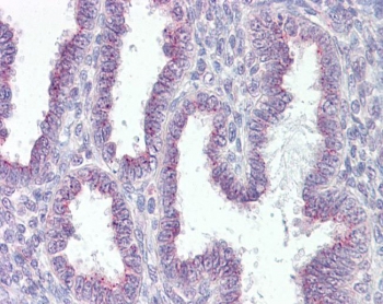 IHC testing of FFPE human uterus tissue with RER1 antibody at 3.75ug/ml. Required HIER: steamed antigen retrieval with pH6 citrate buffer; AP-staining.