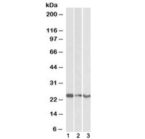 Western blot testing of human 1) cerebellum, 2) frontal cortex and 3) hippocampus lysate with TREM2 antibody at 0.3ug/ml. Predicted molecular weight ~25 kDa.