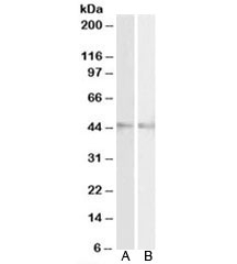Western blot testing of mouse [A] and rat [B] eye lysates with RNF13 antibody at 2ug/ml. Predicted molecular weight: ~43kDa.