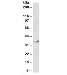 Western blot testing of human cerebellum lysate with NeuroD4 antibody at 1ug/ml. Predicted molecular weight: ~38kDa.