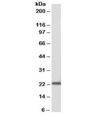 Western blot testing of mouse liver lysate with Ascl3 antibody at 0.1ug/ml. Predicted molecular weight: ~20kDa.