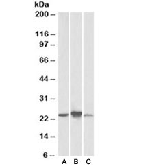 Western blot testing of human [A], mouse [B], rat [C] liver lysate with ABHD14B antibody at 0.3ug/ml. Predicted molecular weight: ~22kDa.