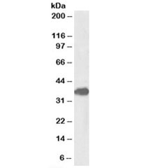 Western blot testing of mouse lung lysate with FOXF1 antibody at 1ug/ml. Predicted molecular weight: ~40kDa.