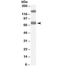 Western blot testing of human liver lysate with ACOX2 antibody at 0.1ug/ml. Molecular weight: the expected ~75kDa band and the additional ~150kDa band are both blocked by the immunizing peptide.