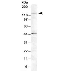 Western blot testing of Jurkat lysate with Tankyrase 2 antibody at 0.5ug/ml. The expected ~125kDa band and the additional ~45kDa band are both blocked by the immunizing peptide.