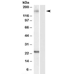 Western blot testing of HeLa lysate with GOLGA3 antibody at 0.1ug/ml. Predicted/observed molecular weight 160~170kDa.