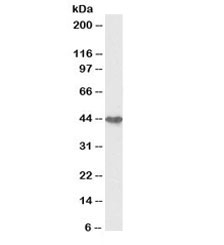 Western blot testing of human colon cancer lysate with biotinylated Cytokeratin 19 antibody at 0.3ug/ml. Predicted/observed molecular weight ~43/40-43kDa.