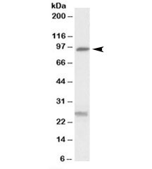 Western blot testing of human kidney lysate with SLC4A11 antibody at 0.3ug/ml. The expected ~95kDa band and the additional ~26kDa band are both blocked by the immunizing peptide.