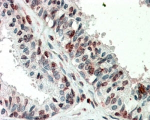 IHC testing of FFPE human prostate with ZIC3 antibody at 5ug/ml. HIER: steamed with pH6 citrate buffer, AP-staining.