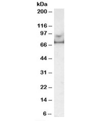 Western blot testing of human prostate lysate with MARK4 antibody  at 0.5ug/ml. Predicted molecular weight: ~75kDa.