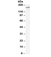 Western blot testing of rat brain lysate with NR2B antibody at 2ug/ml. Predicted molecular weight ~166kDa.