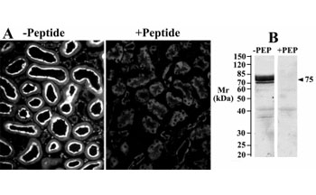 Image A: IHC staining of a rat kidney cryosection with Slc5a1 antibody at 25ug/ml (detection by CY3 fluorescence).  Image B: western blot of brush-border membrane lysate from rat kidney tested with Slc5a1 antibody at 2.5ug/ml.