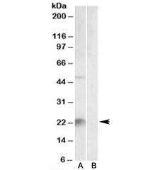 Western blot testing of mouse liver lysate with Kallikrein 6 antibody at 2ug/ml with [B] and without [A] blocking/immunizing peptide. Predicted molecular weight: ~27kDa.