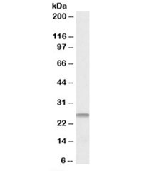 Western blot testing of human heart lysate with CHCHD3 antibody at 1ug/ml. Predicted molecular weight: ~26kDa.