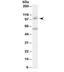 Western blot testing of human peripheral blood mononucleocyte lysate with NOD2 antibody at 0.1ug/ml. Molecular weight: the expected ~100kDa band and the additional ~60kDa band are both blocked by the immunizing peptide.
