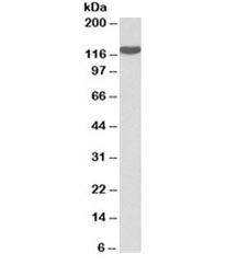 Western blot testing of spleen lysate with ADAM19 antibody at 0.1ug/ml. Predicted molecular weight: 105-125 kDa depending on level of glycosylation.
