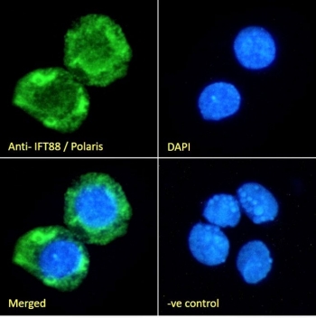 IHC testing of FFPE human kidney with IFT88 antibody at 3ug/ml. HIER: microwaved with pH9 Tris/EDTA buffer, HRP-staining.