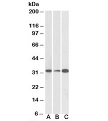 Western blot testing of human [A], mouse [B] and rat [C] brain lysate with EB3 antibody at 0.1ug/ml. Predicted molecular weight: ~32kDa.