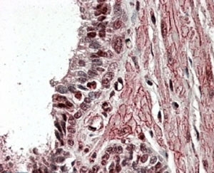 IHC testing of FFPE human prostate with ZNF217 antibody at 4ug/ml. HIER: steamed with pH6 citrate buffer, AP-staining. Nuclear staning in select secretory cells is seen.