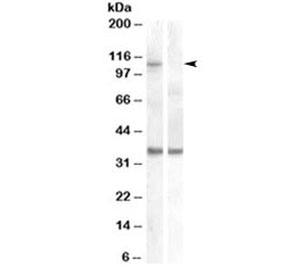 Western blot of HEK293 lysate overexpressing human EIF2C1/AGO1 and probed with AGO1 antibody (non-transfected HEK293 lysate in lane B). Predicted molecular weight: ~95kDa, observed here at ~110kDa.