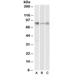 Western blot testing of human [A], mouse [B] and rat [C] lung lysates with DLL4 antibody at 0.3ug/ml. Predicted/observed molecular weight 75~85kDa.