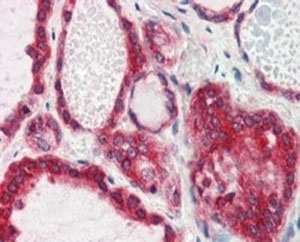 IHC testing of FFPE human thyroid gland with Lipin 3 antibody at 2.5ug/ml. HIER: steamed with pH6 citrate buffer, AP-staining.