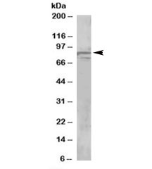Western blot testing of human brain lysate with OSBPL11 antibody at 1ug/ml. Predicted molecular weight: ~86kDa.