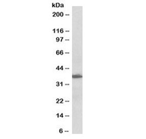 Western blot testing of human lymph node lysate with biotinylated AIMP1 antibody at 0.1ug/ml. Predicted molecular weight: ~34/37kDa (isoforms 1/2).