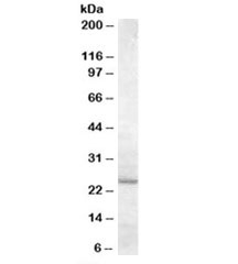 Western blot testing of human liver lysate with MTHFS antibody at 0.5ug/ml with [B] and without [A] blocking/immunizing peptide. Predicted molecular weight: ~23kDa.