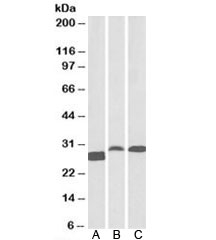 Western blot testing of A) human tonsil, B) rat spleen, C) pig spleen lysates with APRIL antibody at 0.1ug/ml. Predicted molecular weight: ~28kDa.