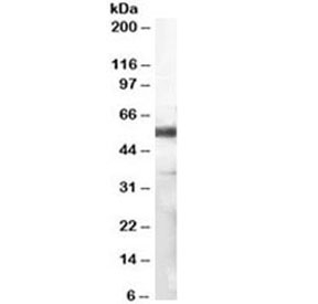 Western blot testing of human lymph node lysate with CD14 antibody at 1ug/ml. Predicted molecular weight 48~56 kDa depending on presence of C-terminal leader sequence on the protein.