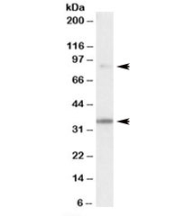 Western blot testing of human skeletal muscle lysate with LDB3 antibody at 0.1ug/ml. Predicted molecular weight: 31-78 kDa (6 isoforms), observed here at ~90/35kDa.