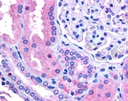 IHC testing of FFPE human kidney with RNF213 antibody at 2.5ug/ml. HIER: steamed with pH6 citrate buffer, AP-staining. Rare nucleoli staining is seen.