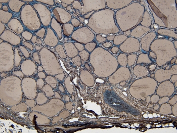 IHC staining of FFPE human thyroid gland tissue with ENPP1 antibody at 4ug/ml. HIER: steamed with pH6 citrate buffer, HRP-staining.
