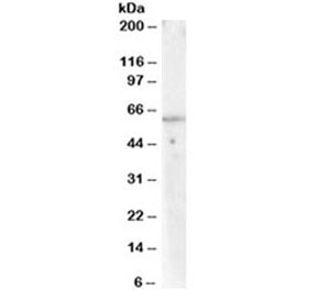 Western blot testing of human lymph node lysate with PPP2R1A antibody at 0.03ug/ml. Predicted molecular weight ~65 kDa.